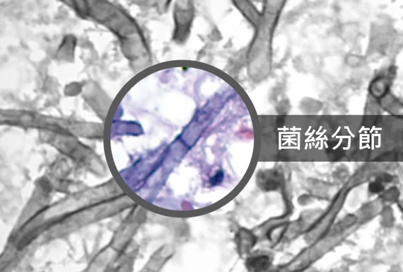 02_HHLin_patho1-570x384